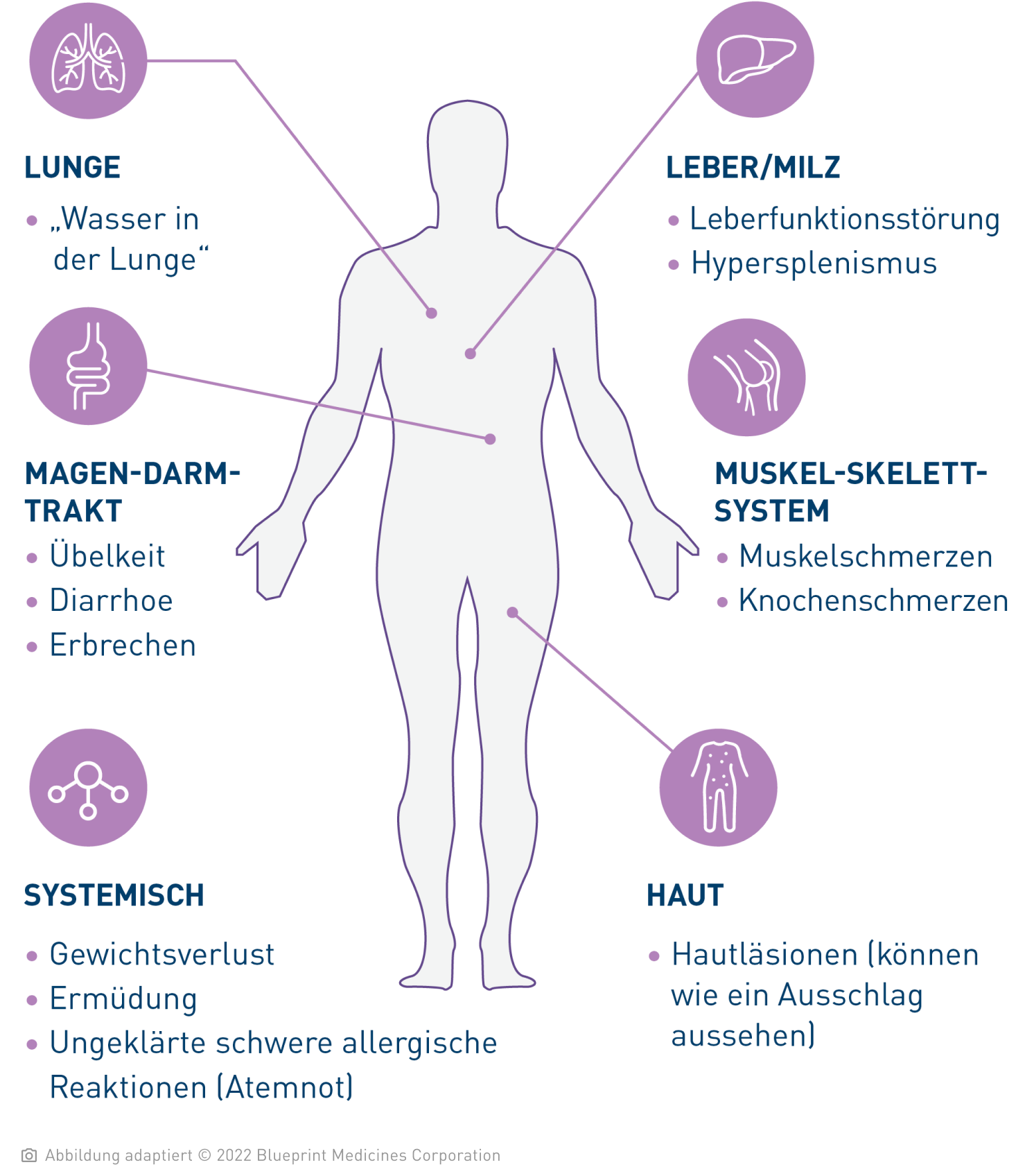 Vereinfachte Illustration eines menschlichen Körpers mit Hinweispfeilen auf die einzelnen Organe: Bei der systemischen Mastozytose treten verschiedene Symptome auf.